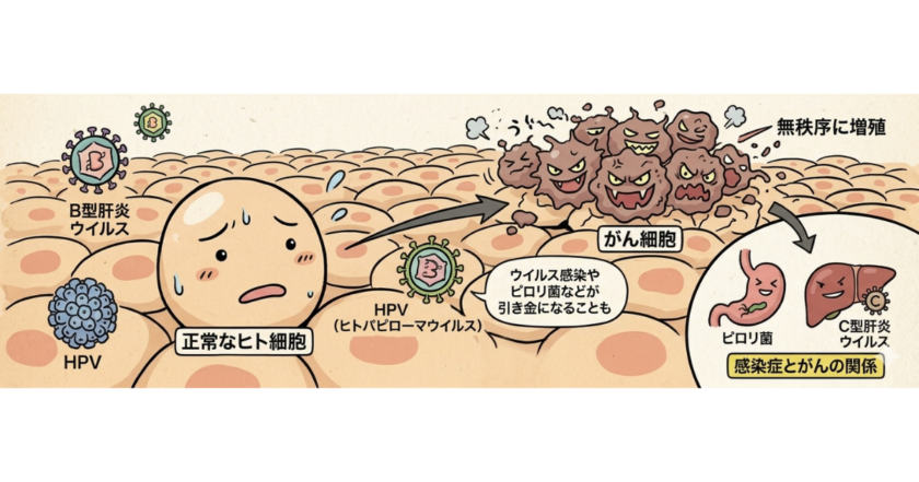 国立がん研究センターのがん予防ガイドラインに基づき、がん原因ウイルス（HPV・B型肝炎・C型肝炎）やピロリ菌が正常なヒト細胞に感染してがん細胞へと増殖する仕組みを分かりやすく図解したイラスト。